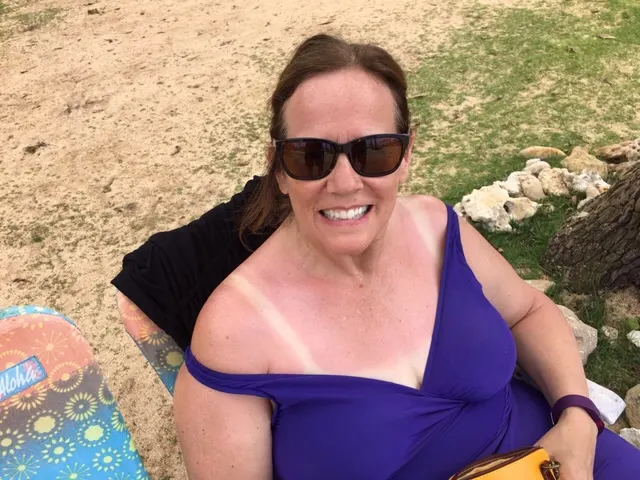 Don't look at the cleavage. This shot is here to show the sunburn...ouch!